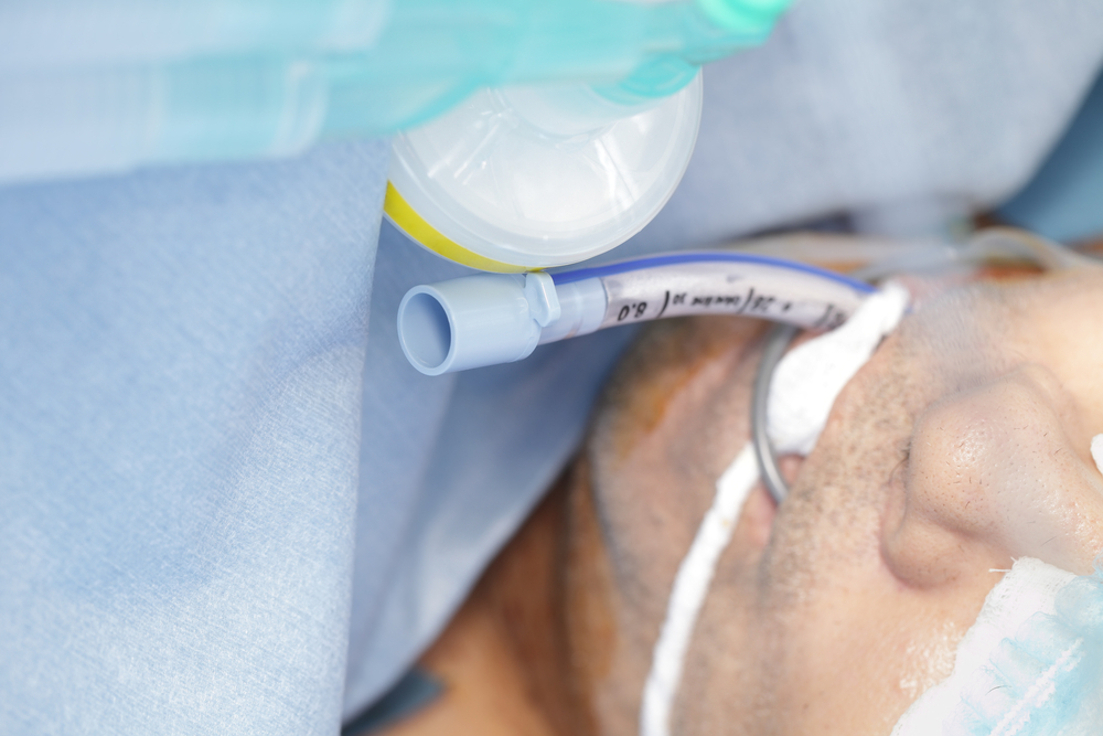 Pain, Agitation and Delirium in Intensive Care ESICM Academy